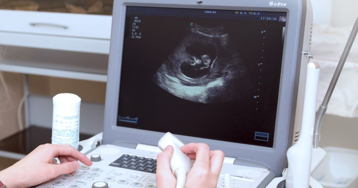 An ultrasound screen is pictured in the stock image above.